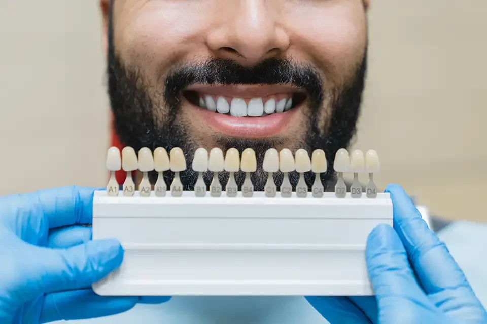 Exploring Dental Crown Alternatives