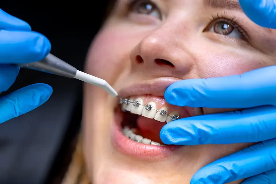 What Is Orthodontics for Adults vs. Teens
