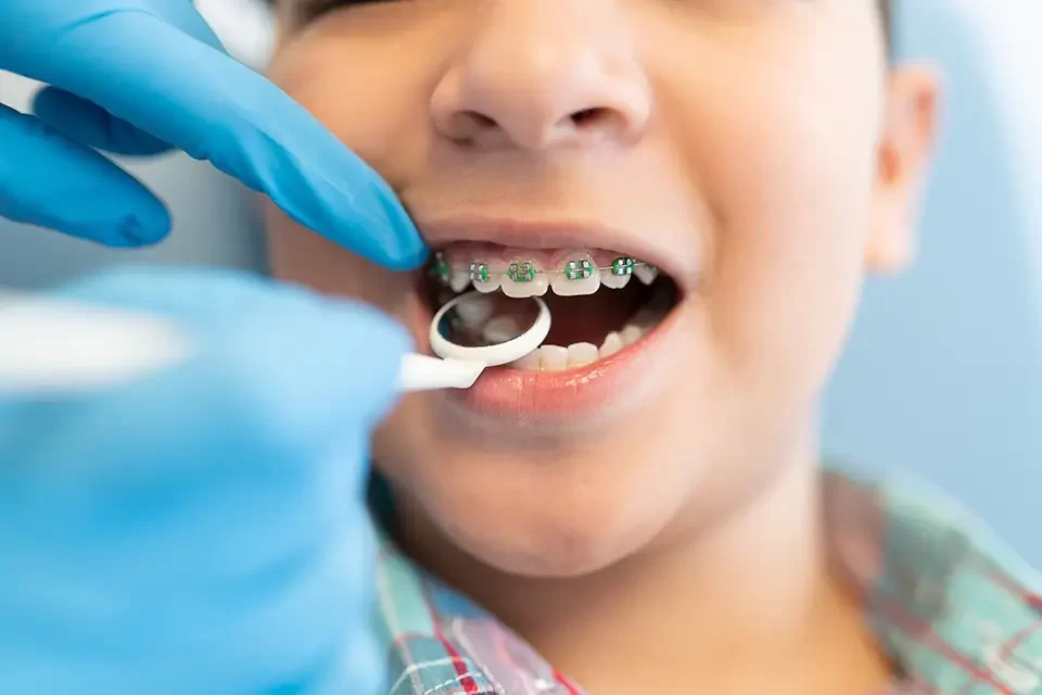 Factors Influencing Orthodontic Treatment Duration