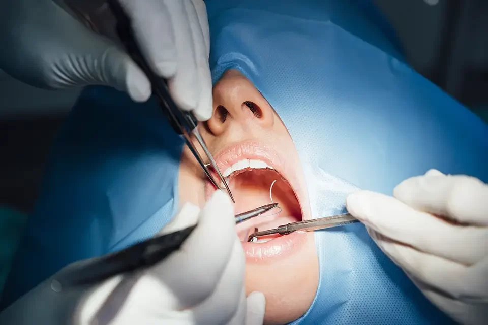 What to Expect During an Oral Surgery Appointment
