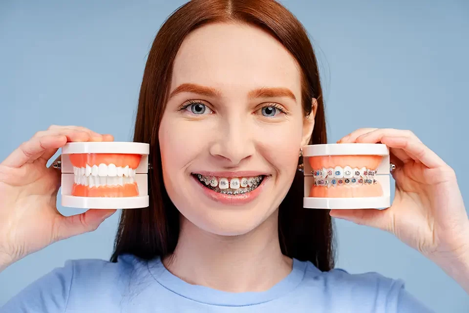 Combination And Limited Treatments: Types of Orthodontic Braces