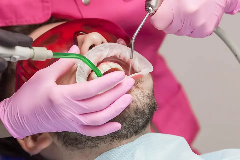 What Shapes Your Root Canal Treatment Cost