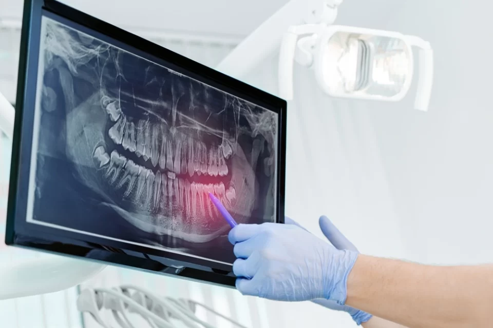 oral surgery oral surgery richmond hill