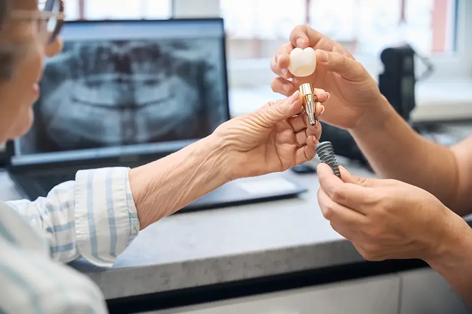 How Long Does the Dental Implant Process Take?