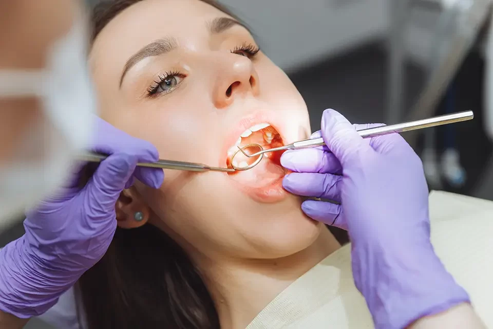 Tooth Filling Types: When Repair Beats Replacement